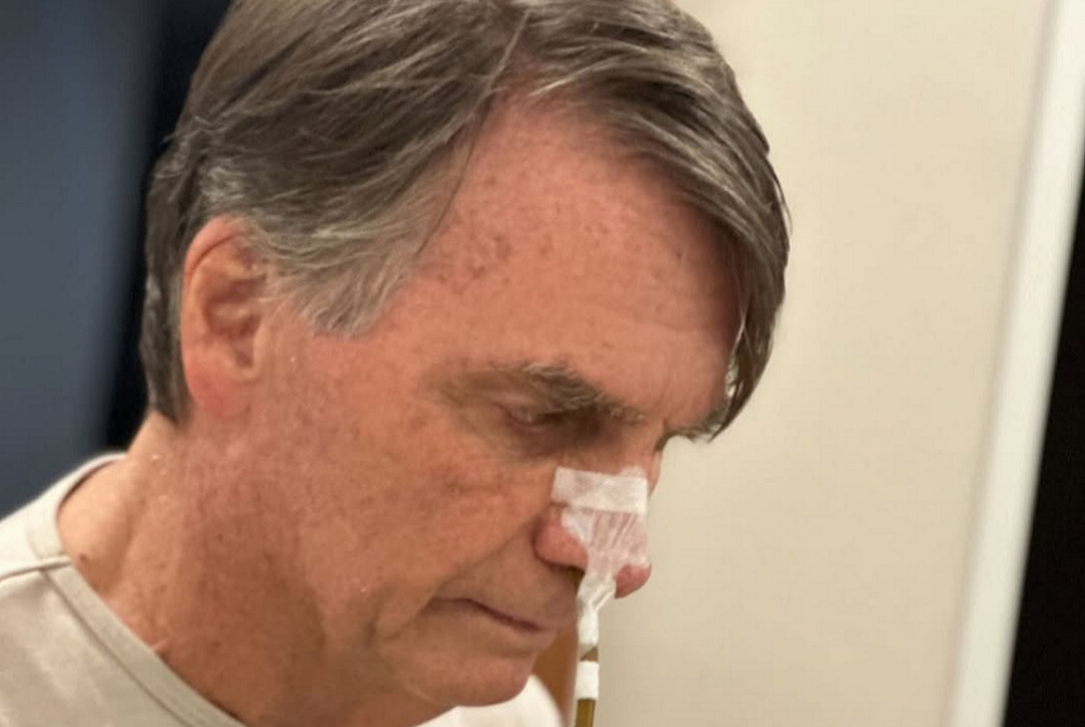 Bolsonaro tem previsão de alta hospitalar nos ‘próximos dias’, diz boletim médico