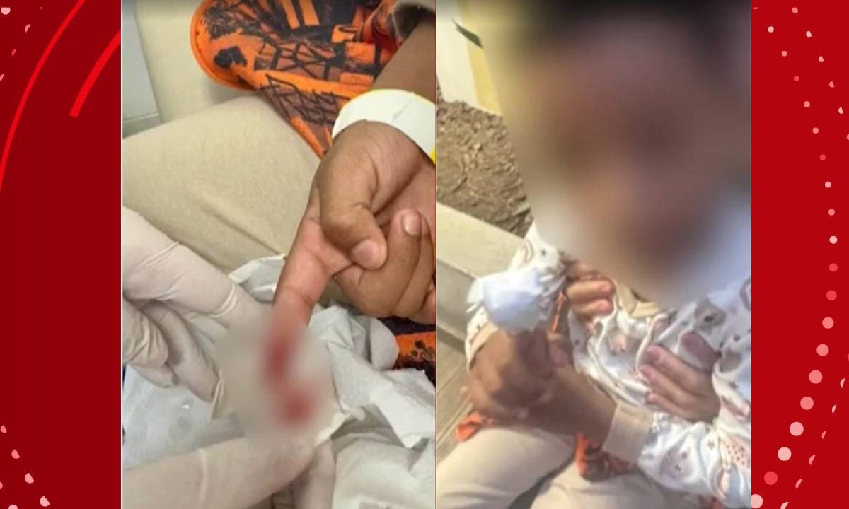 Menino de 6 anos é atacado por piranhas em lago na Bahia